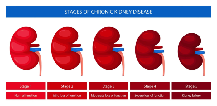 chronic kidney disease