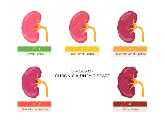 chronic-kidney-disease